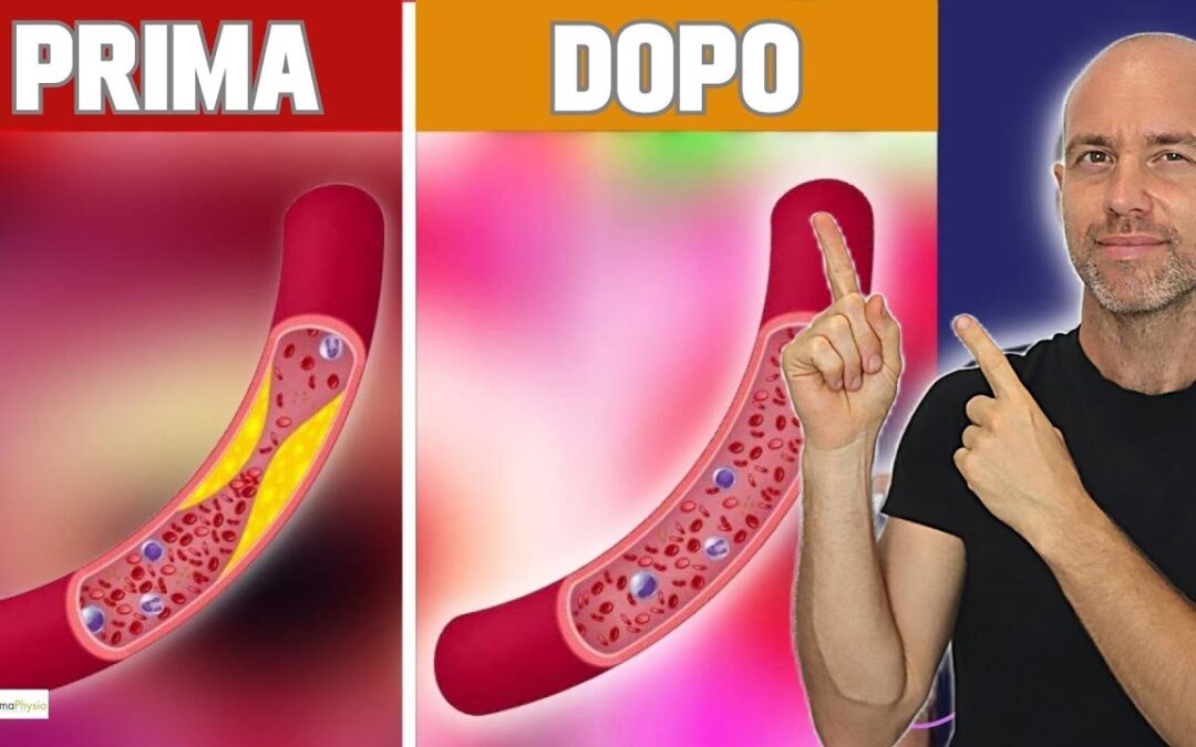 Aterosclerosi, la vitamina K2 può aiutare a ripulire le arterie?