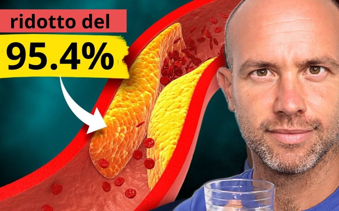 Arteriosclerosi, 4 fattori per pulire le placche nelle arterie.